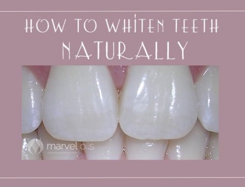 Naturally Whiten Teeth